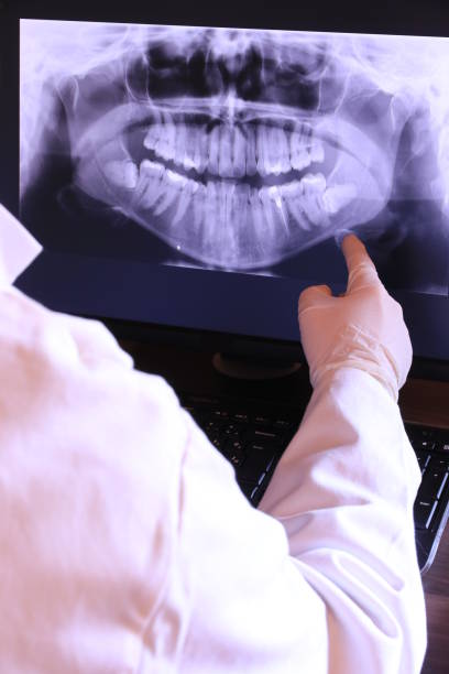 Best Dental Abscess Treatment in Ocean Pointe, HI