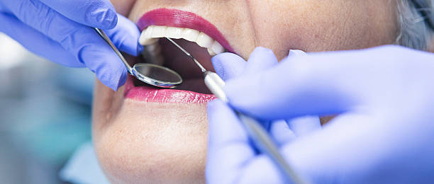 Best Knocked-Out Tooth (Avulsed Tooth) Treatment in Ocean Pointe, HI
